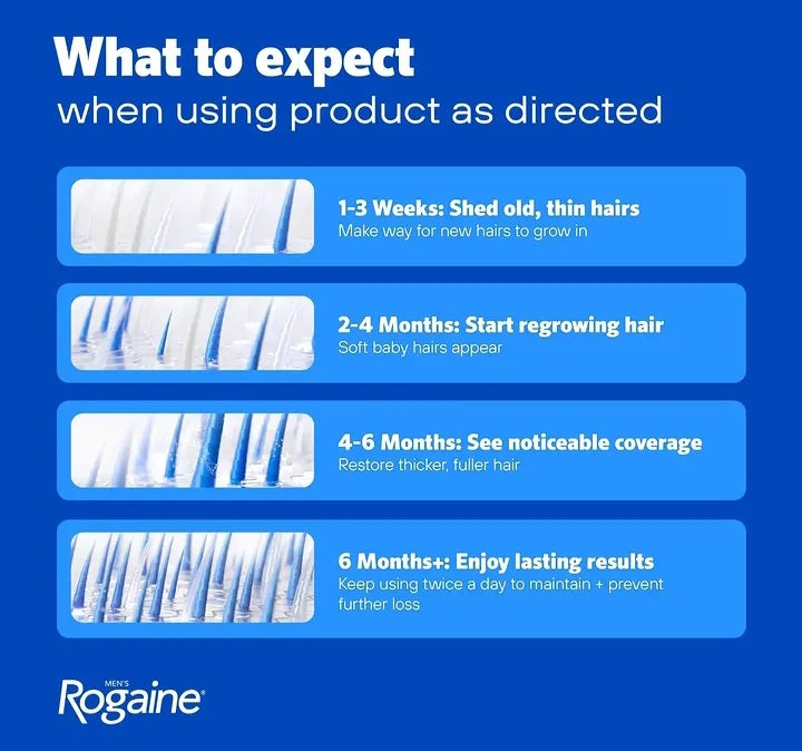 Men's Rogaine Extra Strength 5% Minoxidil Topical Solution