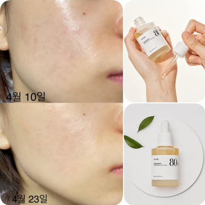 Anua Heartleaf Soothing Ampoule, with a clear liquid visible inside the glass container, placed on a white plate with a leaf on the top and the brand name 'Anua' mentioned.

