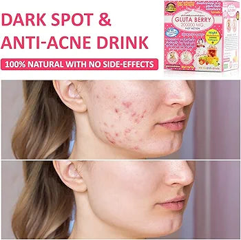 Gluta Berry 200,000 MG 🍓✨