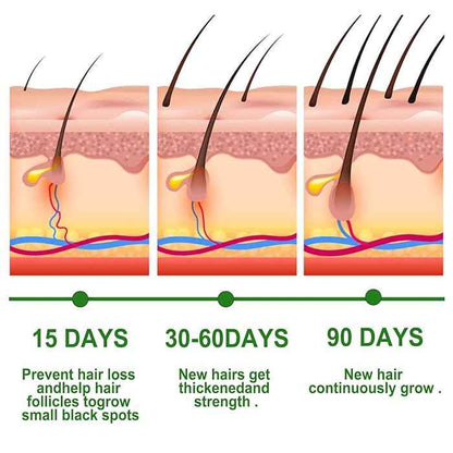 Rosemary Hair Growth Essential Oil Prevent Hair Loss Nourish Scalp Strengthen Hair