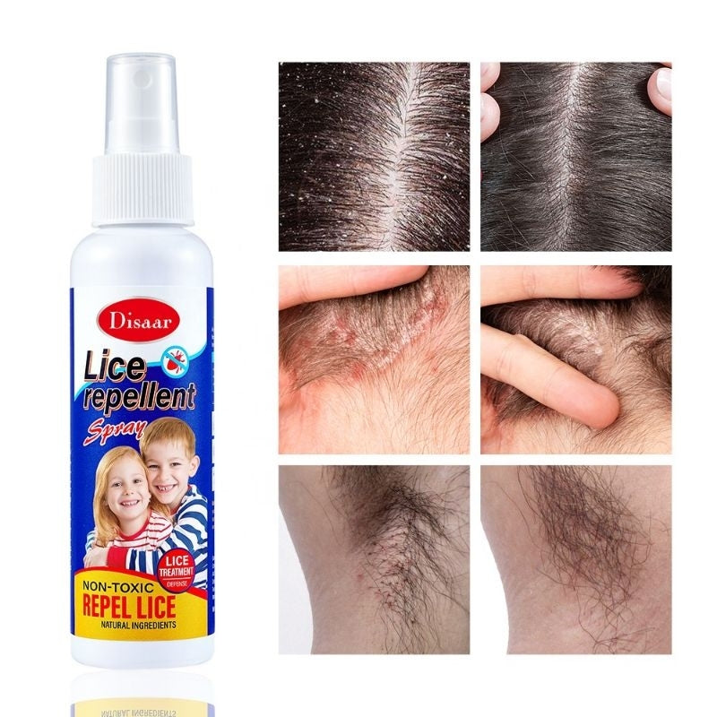 Lice repellant spray bottle with images of lice infestations on a white background

