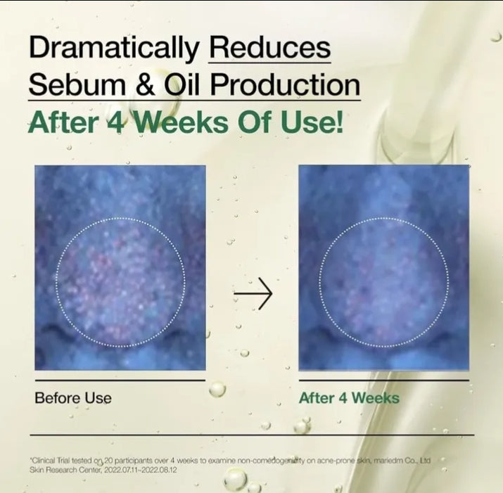 Before and after comparison of sebum and oil production with text indicating reduction after 4 weeks of use.

