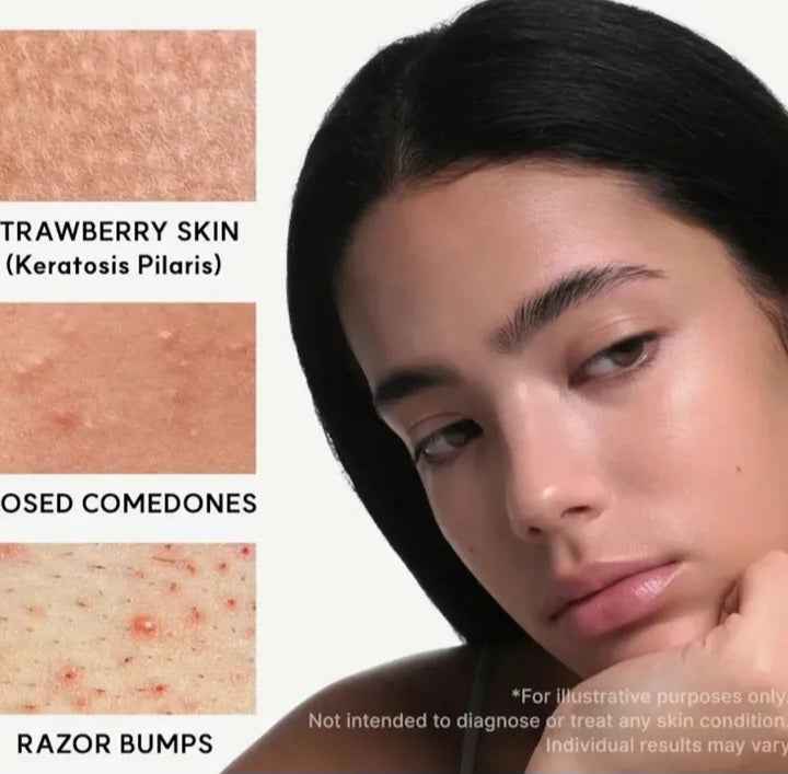 Arencia Eraser Shot Glycolic Acid Booster