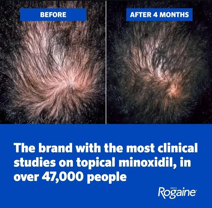 Men's Rogaine Extra Strength 5% Minoxidil Topical Solution