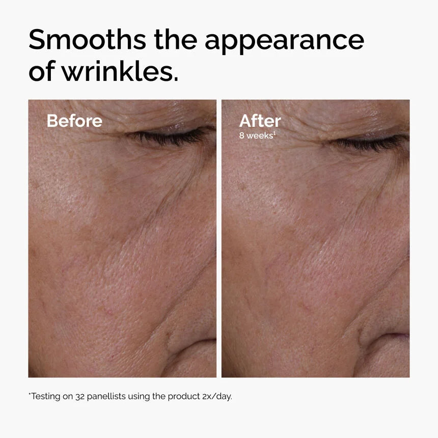 Before and after comparison of wrinkles on skin with text indicating product effectiveness.