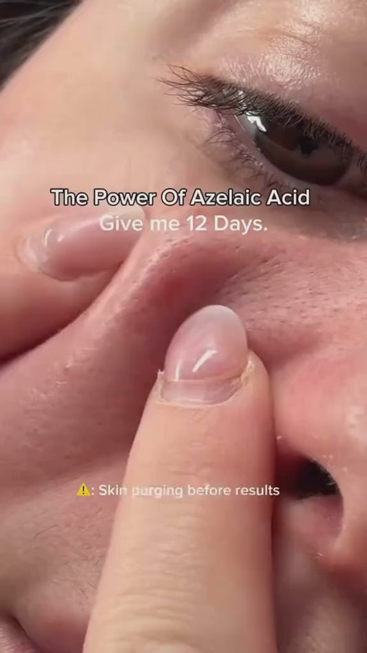 Anua Azelaic Acid 10+ Hyaluron Redness Soothing Serum